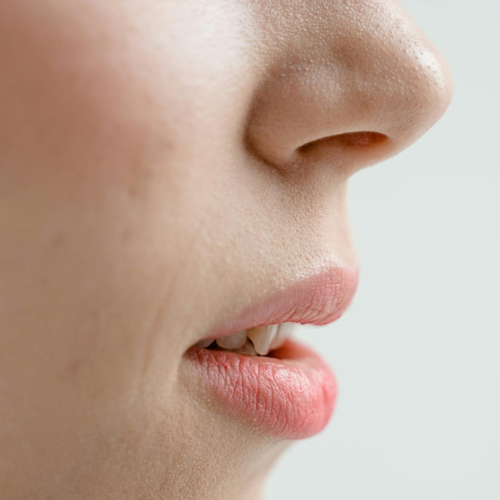 A side profile showing a lifted, alert eyelid, representing the results of a surgical ptosis correction for a droopy eyelid at Medinova.