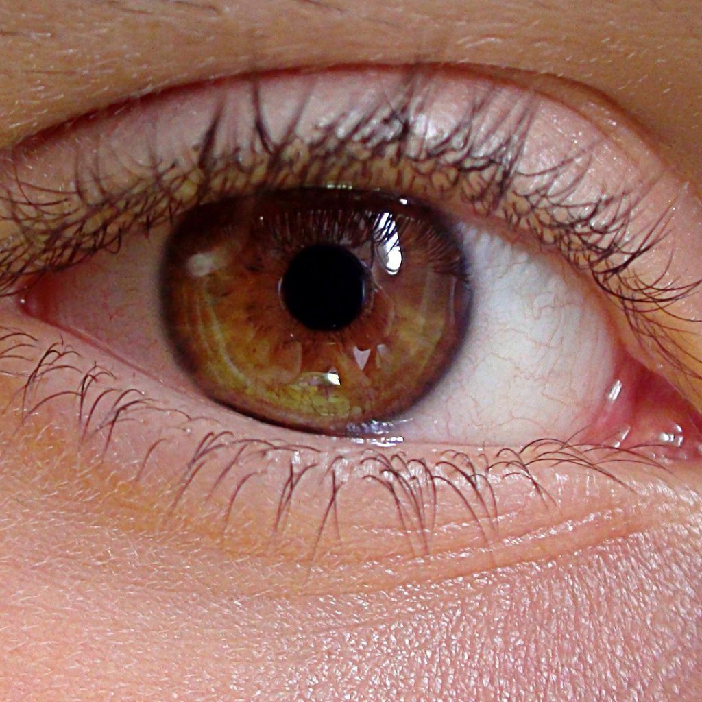 A close-up view of a smooth, refreshed under-eye contour, showcasing the result of a scarless eyebag removal procedure at Medinova.